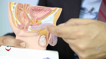 التسرب الوريدي وضعف الانتصاب